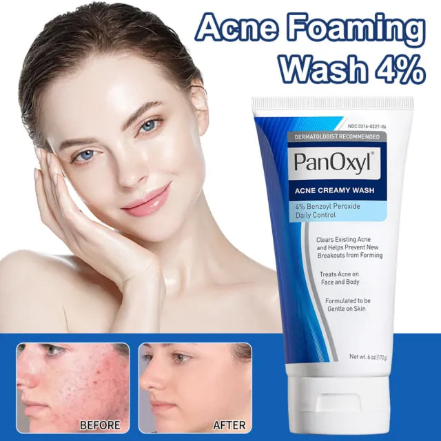 PanOxylÂ® Acne Creamy  Wash Benzoyl Peroxide 4% 156g